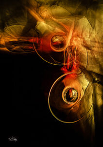 Tendonitis - David Day